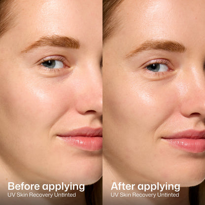 UV Skin Recovery Duo Kit