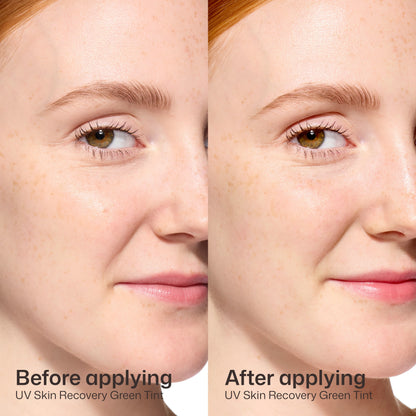 UV Skin Recovery Duo Kit