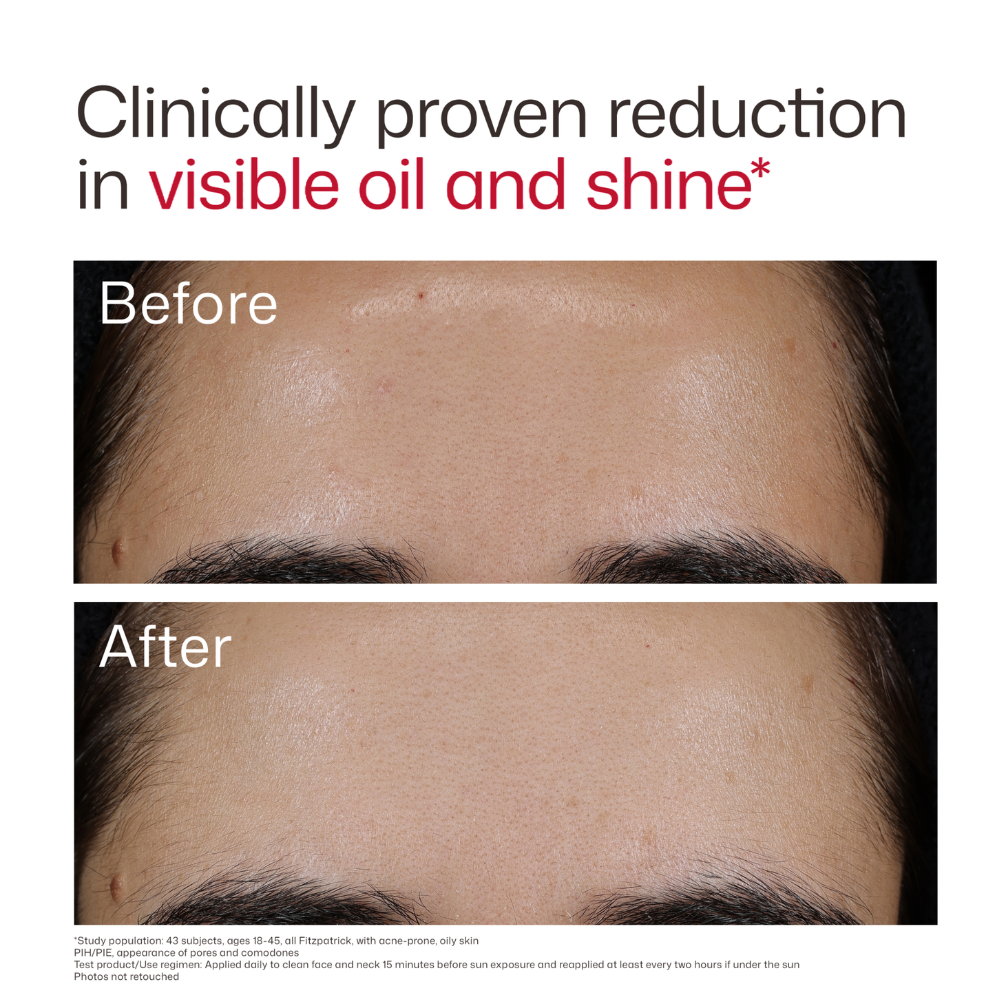 UV Clear Blemish-Prone & Oil Balancing SPF 50
