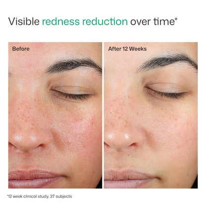 UV Skin Recovery Duo Kit